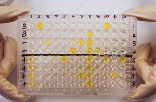 Major applications and principles of Indirect and sandwich ELISA