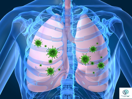 Role of nano-vaccine for respiratory infection