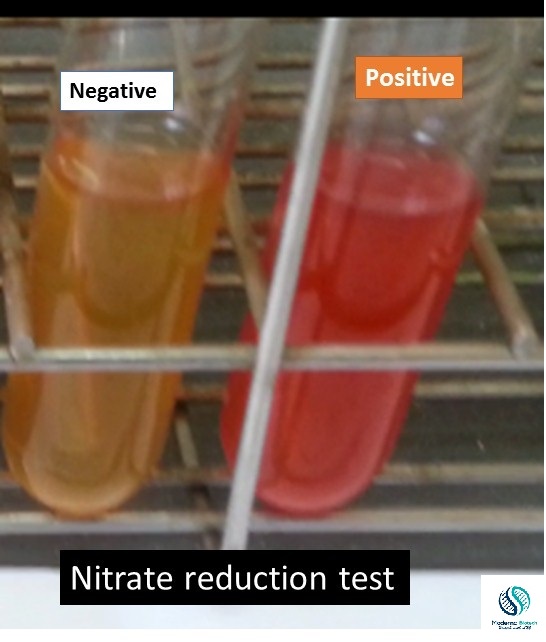Nitrate reduction test