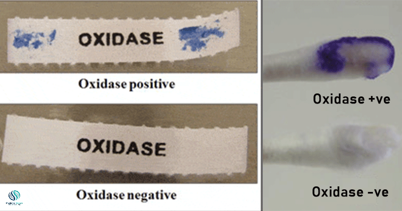 Biochemical tests for Staphylococcus aureus