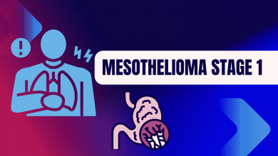 Photo of Mesothelioma Stage 1: Early Diagnosis and Prognosis – Latest 2023