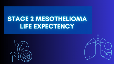 Photo of Stage 2 Mesothelioma Life Expectancy – Latest 2023