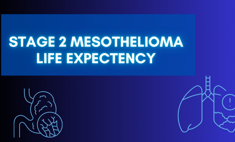 Stage 2 Mesothelioma Life Expectency